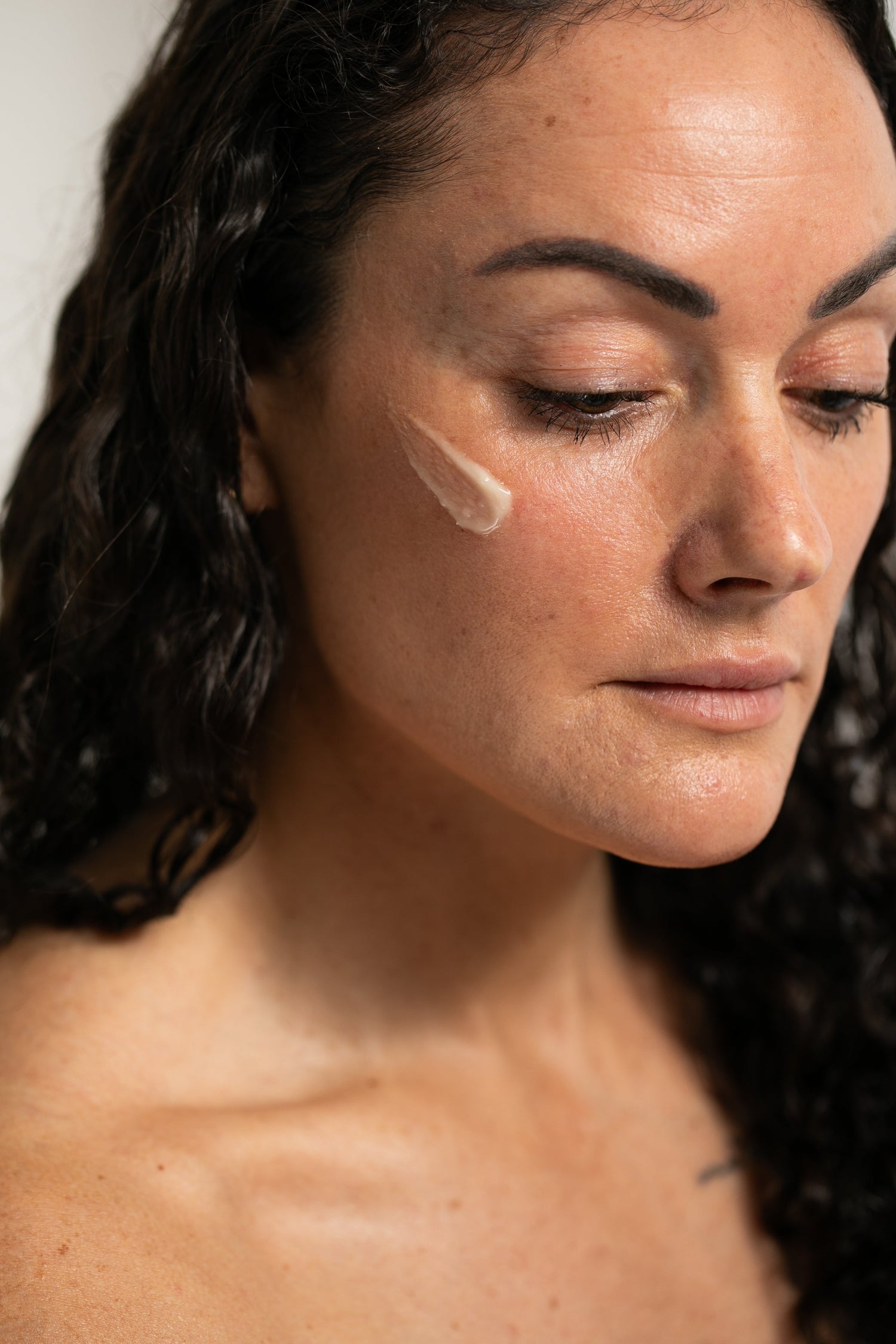 Acne Prone Skin